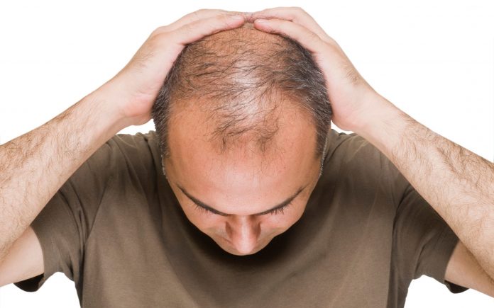 How to stop Hair Fall?